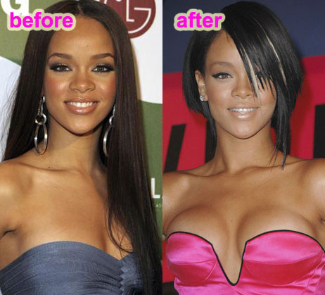 rihannaplasticsurgery.jpg