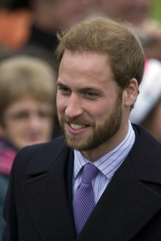 prince william bald spot prince william ginger. is Prince William#39;s new,