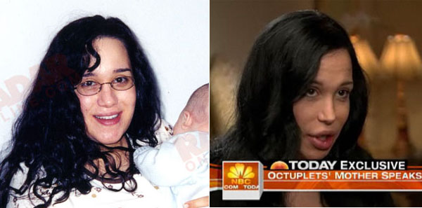 Cele|bitchy » Blog Archive » Nadya Suleman before plastic surgery; 