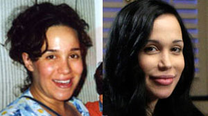sulemanbeforeafter2 sulemanbeforeafter2