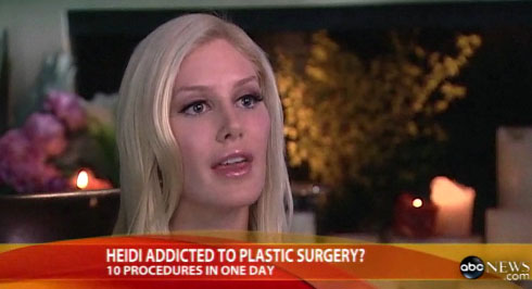 heidi montag before and after plastic surgery interview. Heidi Montag is getting her