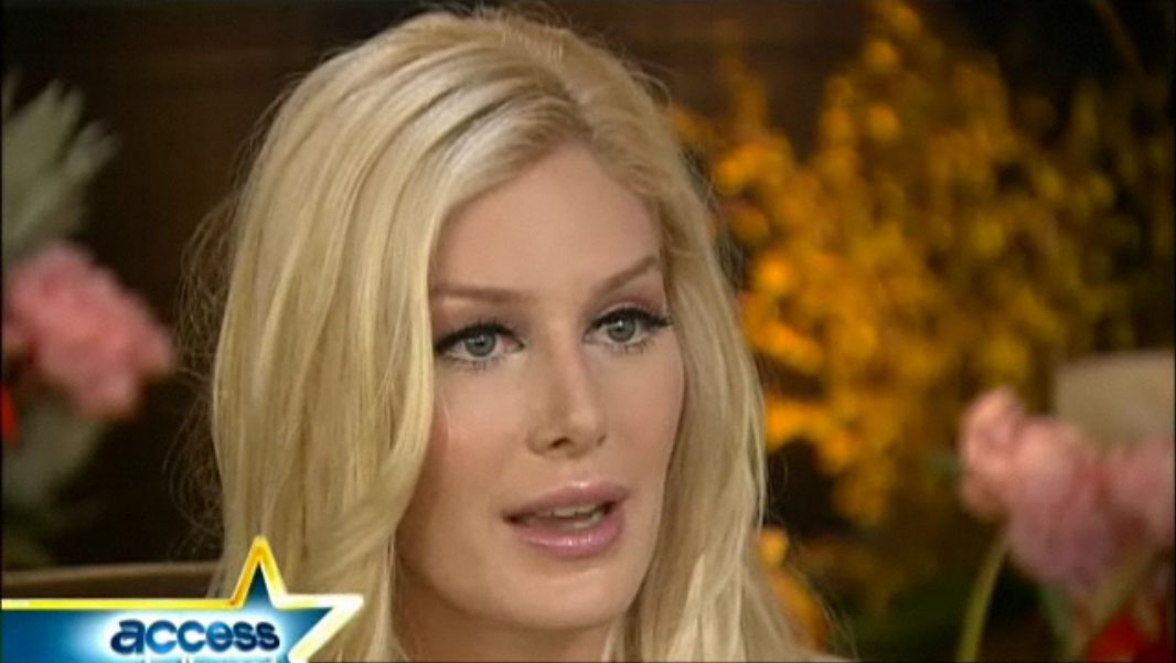 heidi montag after surgery. Heidi Montag says her decision