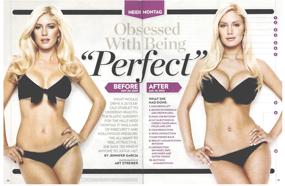 heidi montag plastic surgery before and after people. Heidi Montag is still trying