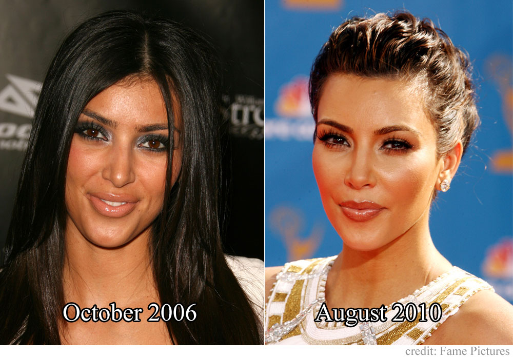 Here's a before and after for Kim that doesn't even capture what she's done 