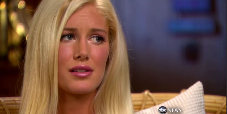 heidi montag before and after plastic surgery interview. Then they had that interview