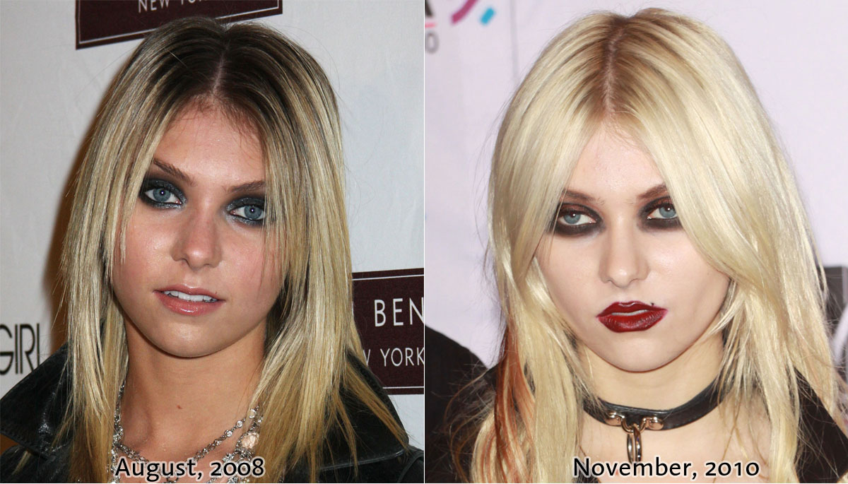 taylorbeforeafter