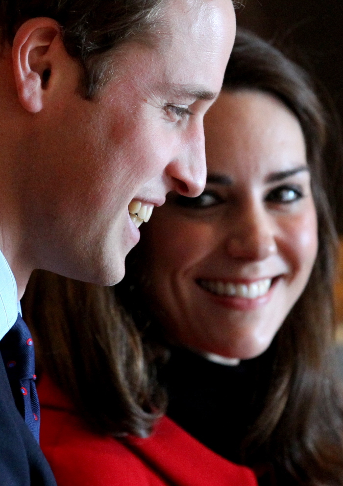 is prince william balding. prince william hair loss