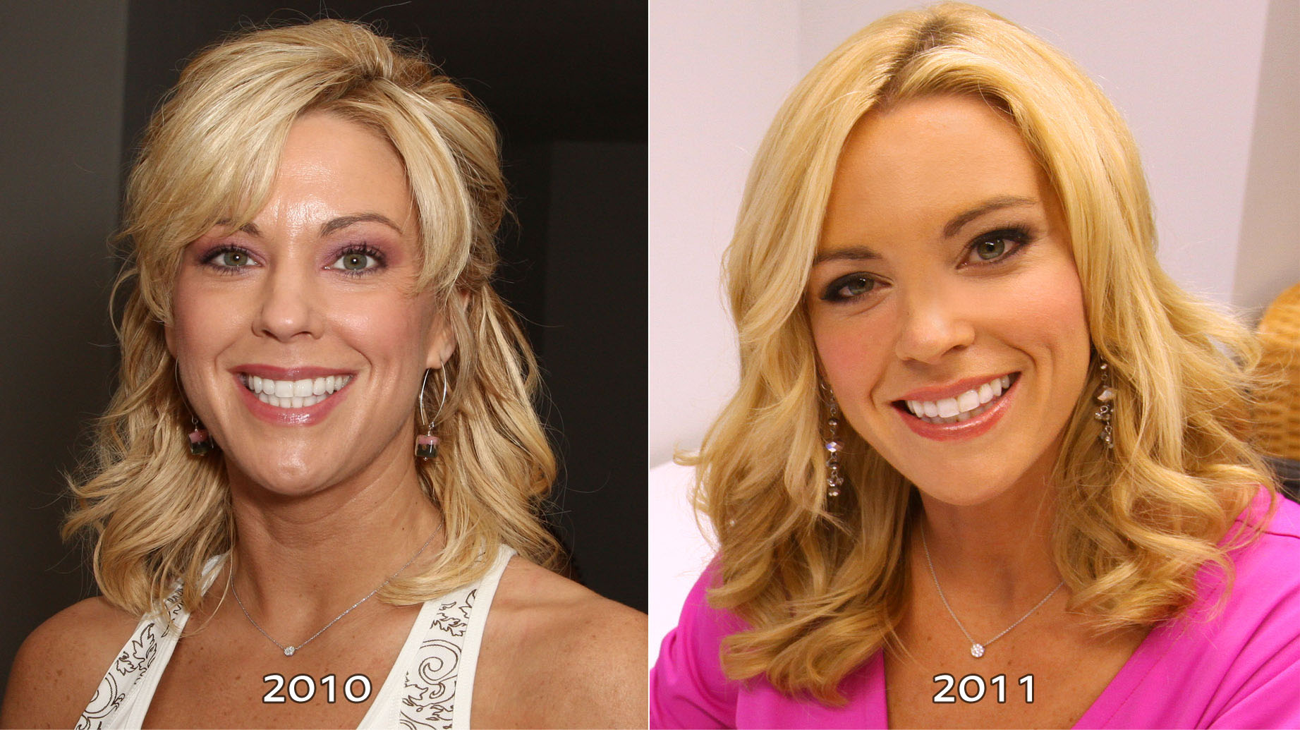 Cele|bitchy | What did Kate Gosselin do to her face: facelift, fillers, and/or nips ...
