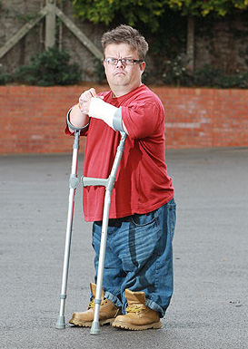 Picture of midget on crutches