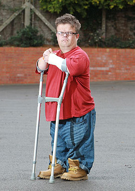 Amber recommends best of Midgets with crutches with crutches Midgets