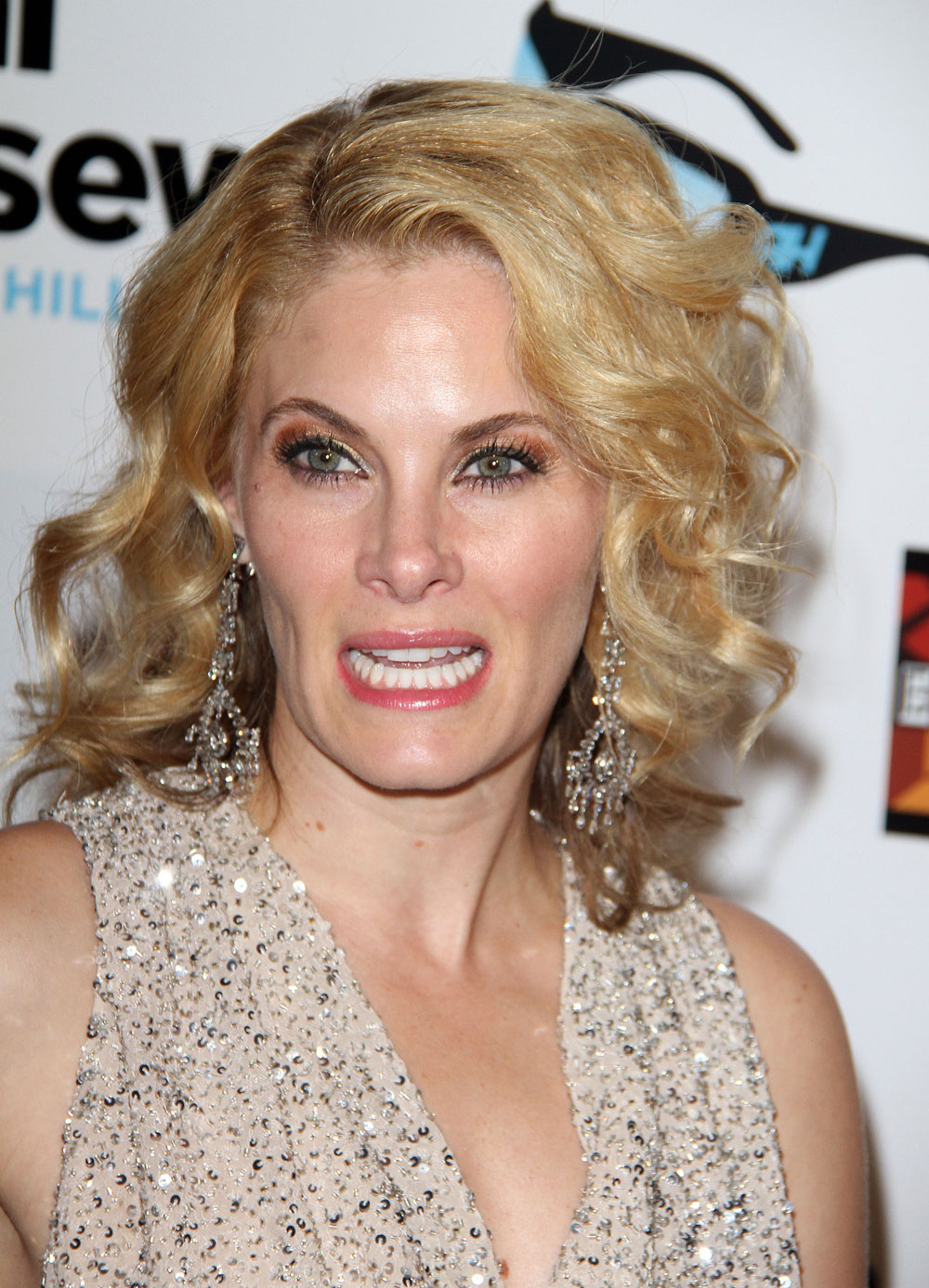 Plastic Surgery Overdone