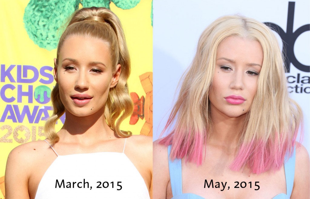 iggybeforeafter