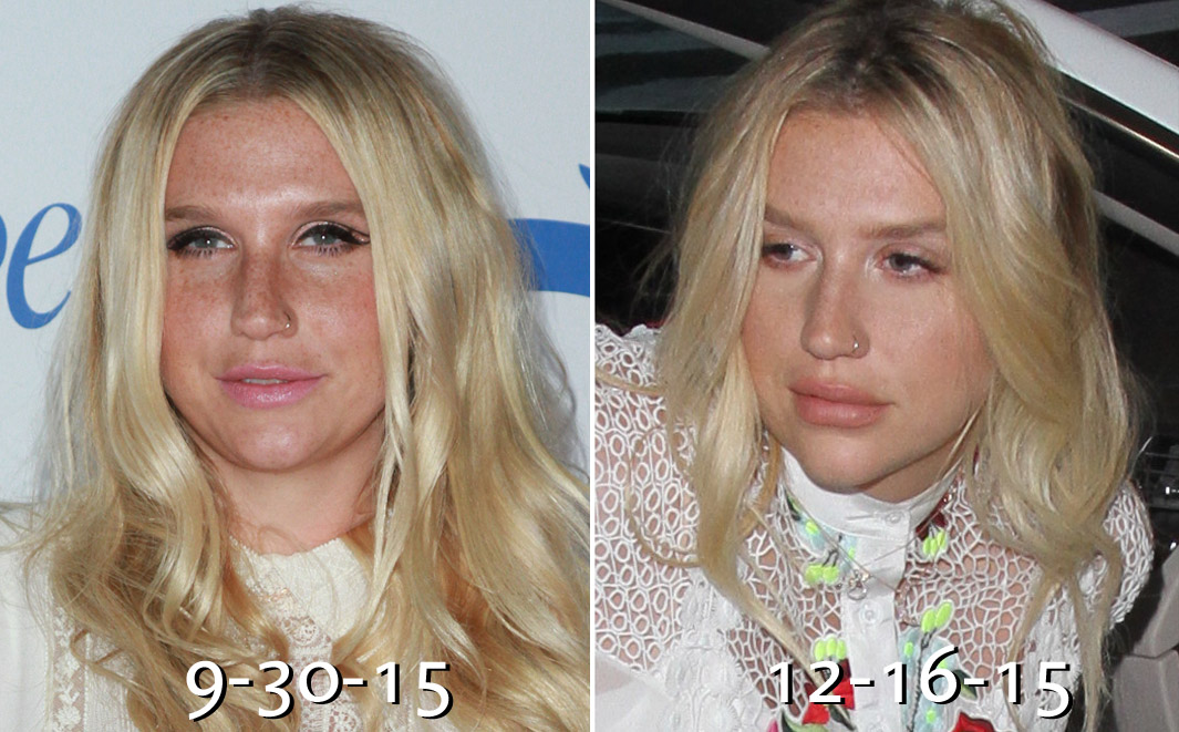 Kesha departs on a flight from Los Angeles International Airport