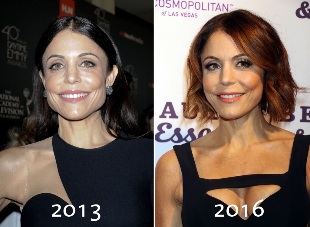 bethennybeforeafter