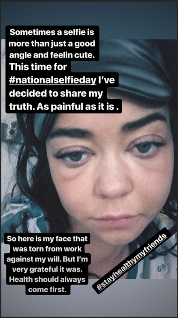 SarahHylandSwollenFaceIGStoryviaUSWeekly