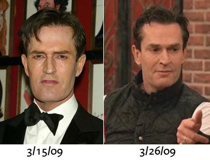 Rupert Everett gets a new face, thanks to surgery and Botox.