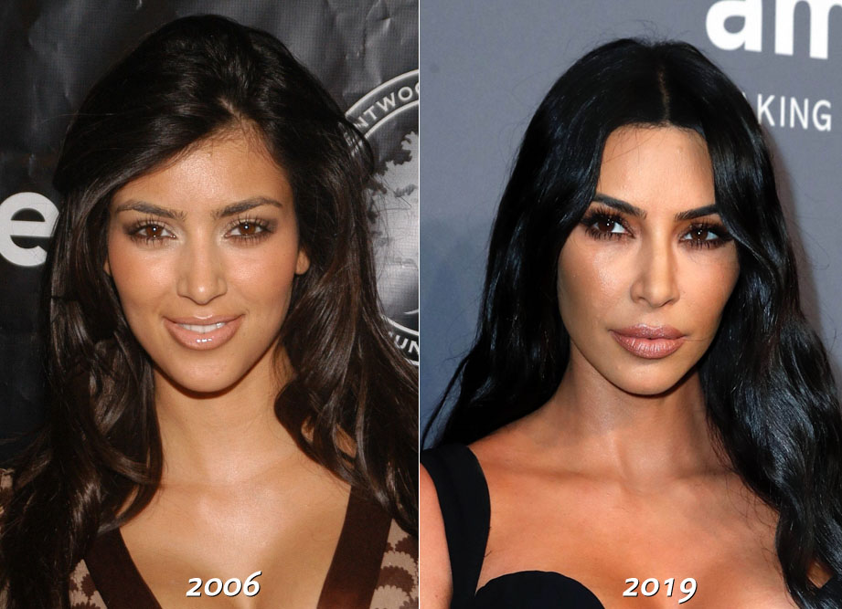 kimkbeforeafter