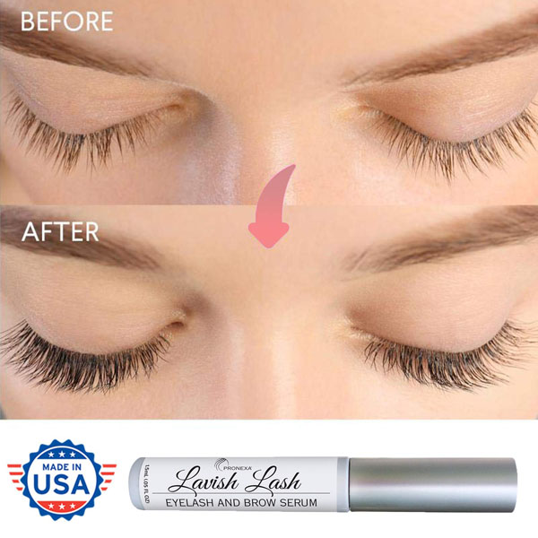 AmazonEyelashSerum2