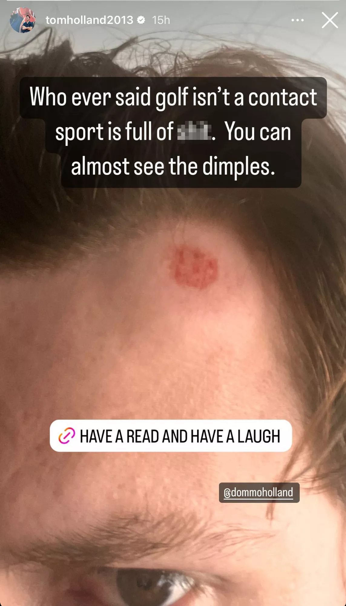 Tom Holland got hit in the forehead by a golf ball, was saved by his ‘wooly hat’